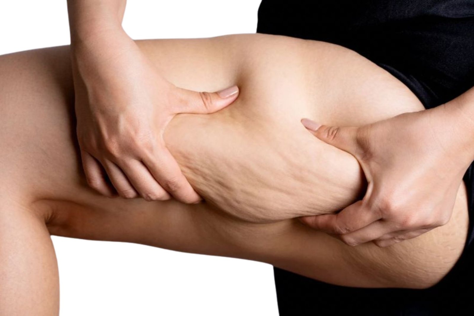 Tratamentos Corporais para Tratamento de Celulite